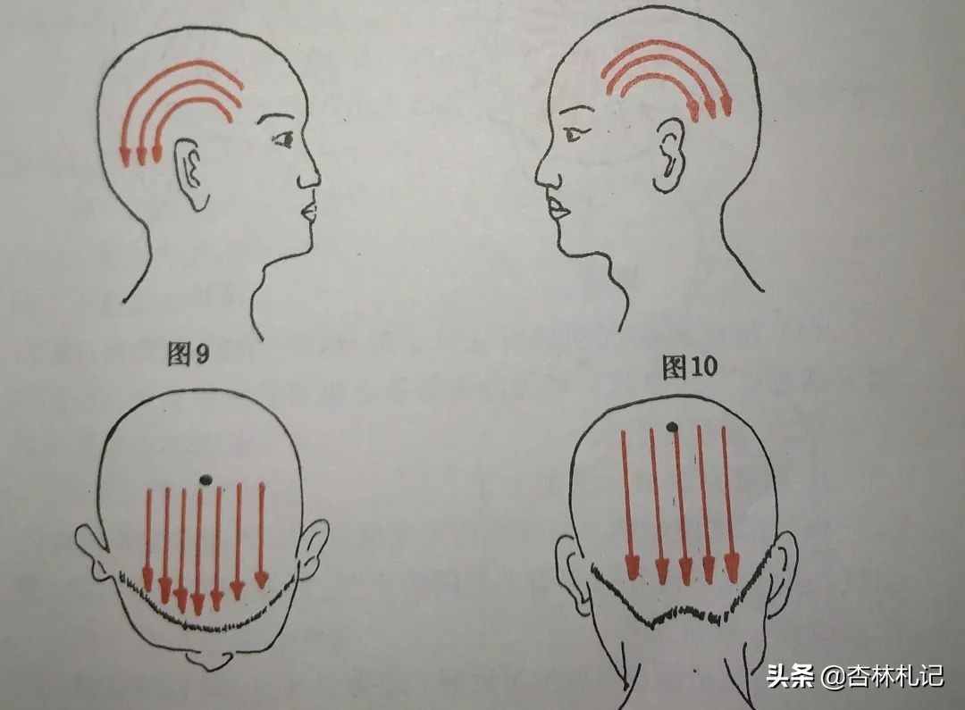 怎样刮痧脸部才是正确的,面部如何刮痧才正确