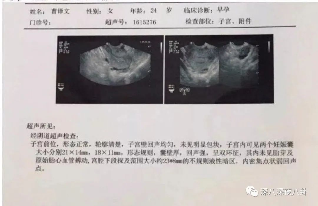 翻车打脸的故事,翻车打脸