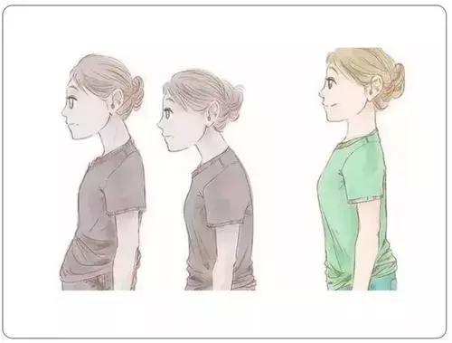 矫正胸型防驼背,驼背怎么矫正扩胸