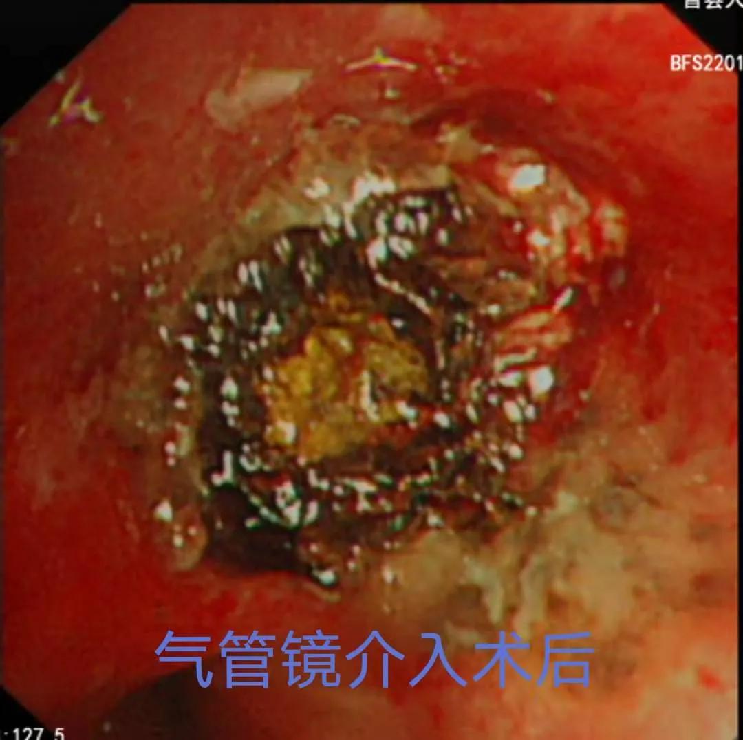 光动力:黑暗中的曙光文/张奎松冯炳振