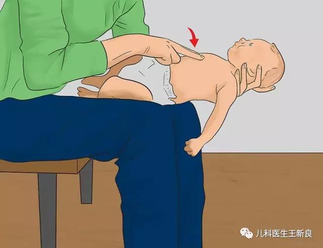 异物卡喉快用海姆立克法抢救,异物卡喉海姆立克急救方法