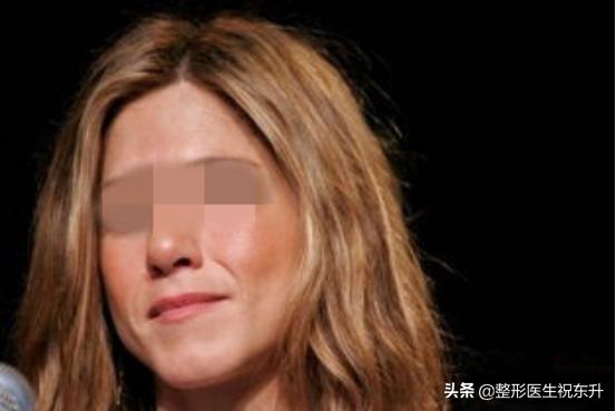 打肉毒素治疗面部发红发热,打肉毒素脸僵硬吃什么