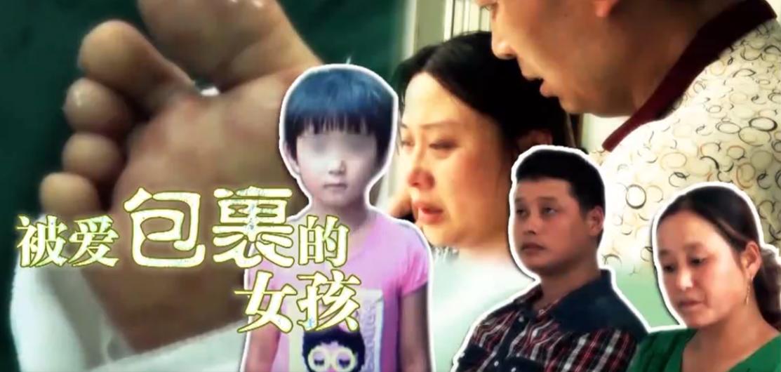 8岁女孩罕见怪病后续,8岁女孩罕见怪病