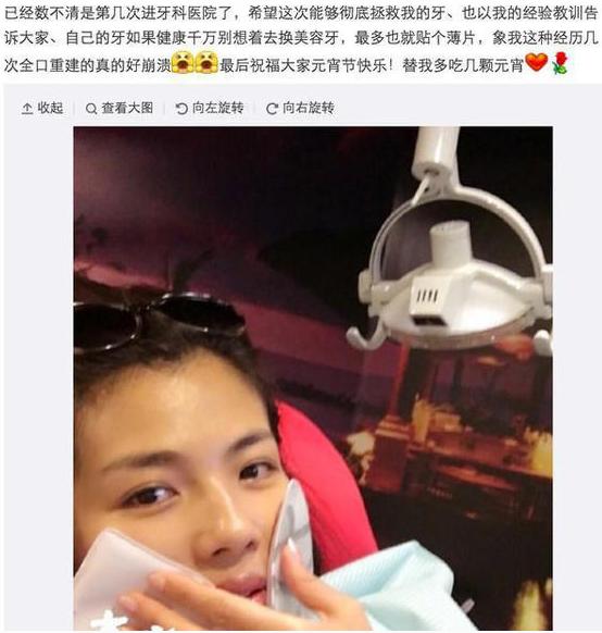 刘涛同款烤瓷牙,刘涛的牙齿烤瓷牙和全瓷牙