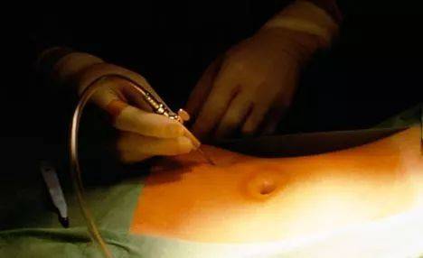 没有身体接触就会没有安全感,没有身体接触算阻挡吗