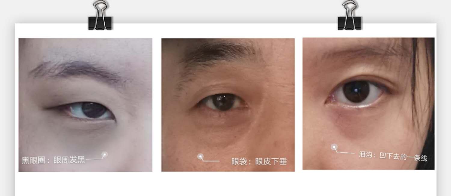 自然光遮泪沟黑眼圈教程,最全黑眼圈泪沟遮瑕大法