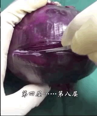 剖宫产简直痛到怀疑人生,剖宫产三次全过程