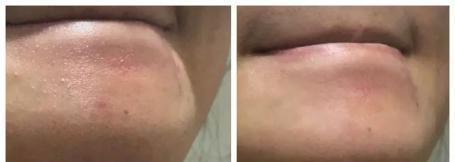 火山泥真是宝,油皮女孩的毛孔疏通剂,让贵妇霜3秒吃透锁水8倍