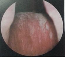 山东治疗泌尿外科比较好的医院,山东大学附属医院泌尿外科专家