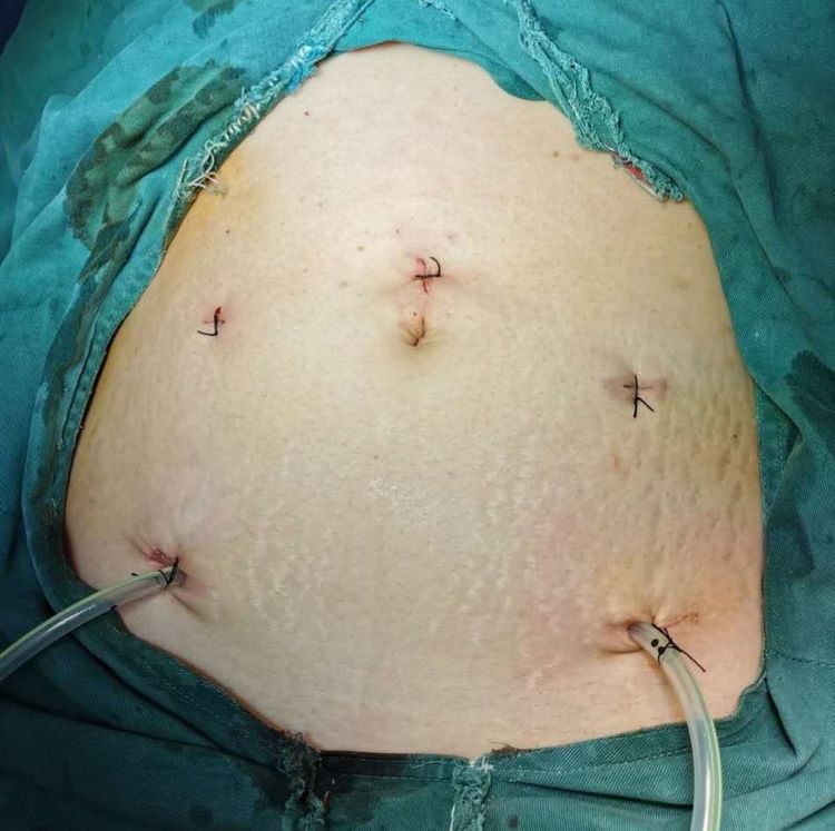 娓崡甯傜浜屽尰闄㈣偪鐦よ兏澶栫,鑲跨槫鍖婚櫌鑳镐簩澶栫