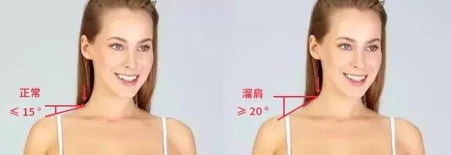 三个姿势改善体态,3个让人变丑的动作