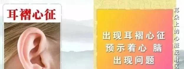 耳朵上血管明显怎么回事,冠心病耳朵褶皱一般在左耳吗