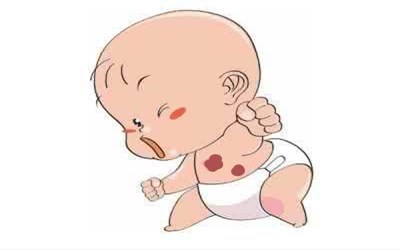 血管瘤为何这么容易复发,血管瘤经常复发该怎么办