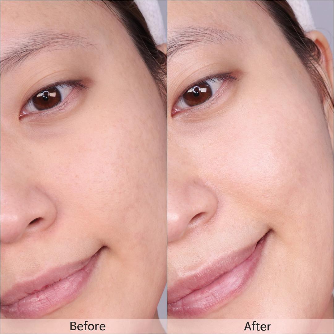 城野医生美白精华正确使用方法,美白神器仪器