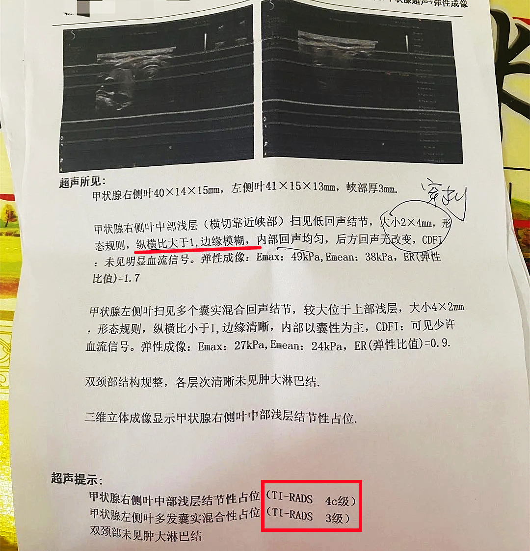 甲状腺跟工作环境有关系吗,甲状腺跟工作环境有关吗