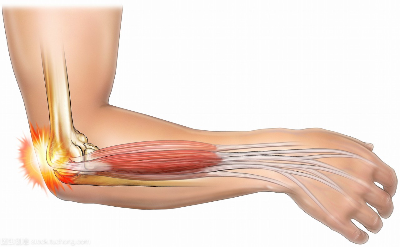 疼痛是什么？我们从事肌骨疼痛方向的物理治疗师究竟在干什么？