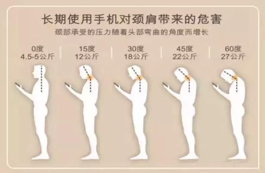 改善脖子前倾的动作视频,脖子前倾毁了无数人3个动作