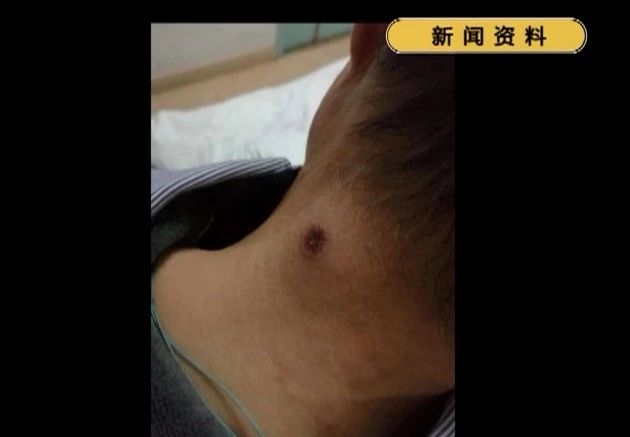 *处私**被咬，女童不幸离世，要命的虫子专盯这3种宝宝，家长要注意