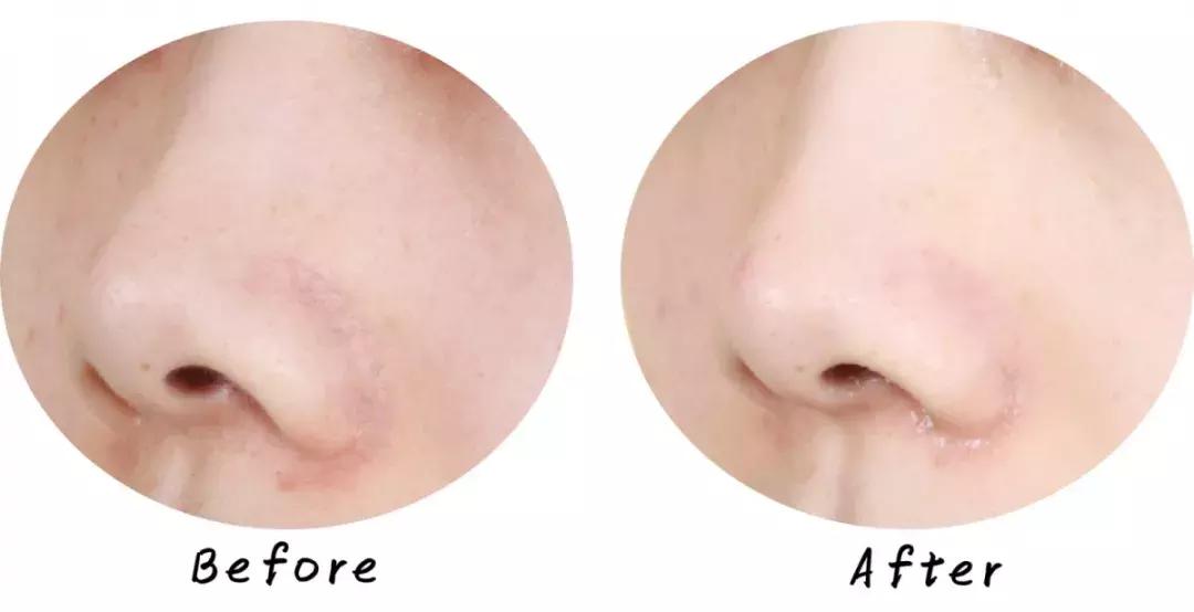 最好用清洁面膜排行榜前十名图片,公认最好用的清洁面膜混油皮