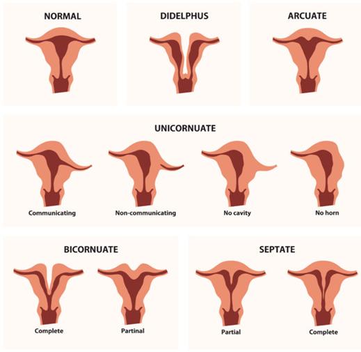 怀3胞胎的宝妈,女人怀了3胞胎快生了