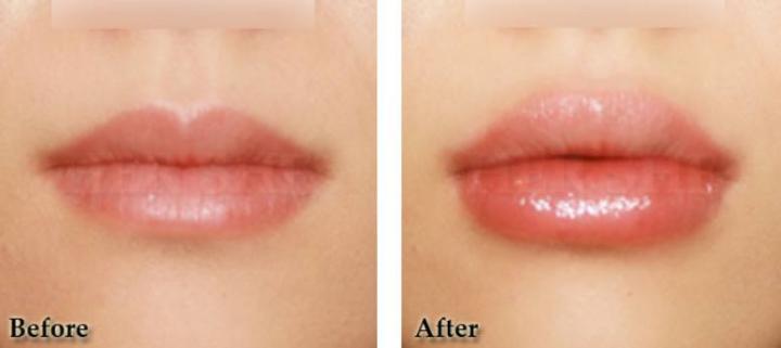 用了上百只润唇膏，Blistex小蓝罐最鸡肋，曼秀雷敦性价比？