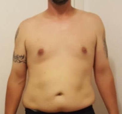 如何减掉胸部脂肪男性,男生胸部脂肪堆积什么样的