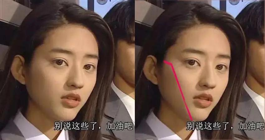 如何垫下巴看起来又翘又尖,怎么垫下巴改善下巴短平