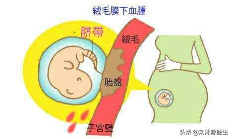 免疫相关不良妊娠答疑解惑,免疫不良妊娠检查什么