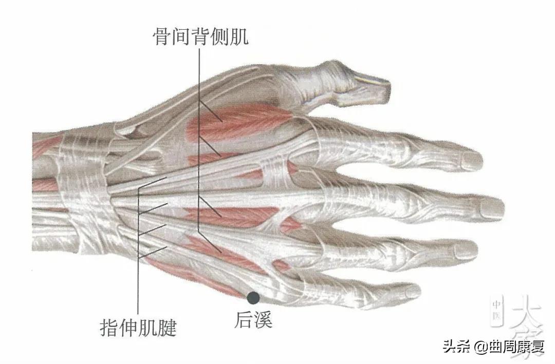 一针透两穴治愈落枕医案,针灸治疗落枕有奇效