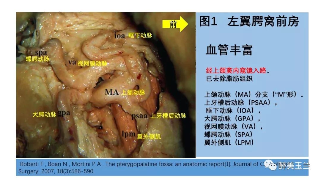 病例分享丨三叉神经节微球囊压迫术的麻醉管理