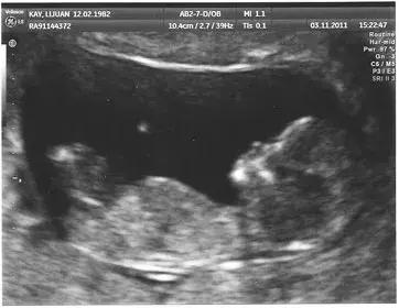 超声专家是做b超还是看结果,超声影像检查专家