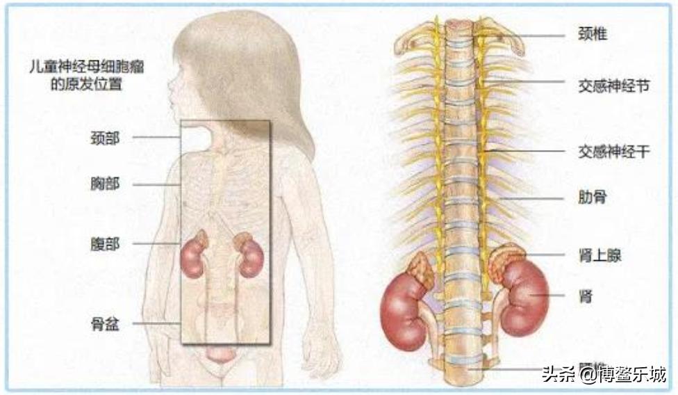 治疗神经母细胞瘤靶向药纳入医保,神经母细胞瘤GD2免疫治疗