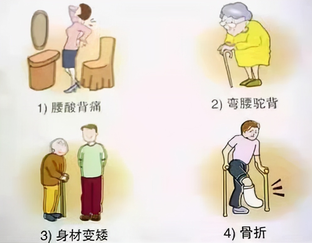 健康科普骨质疏松症,骨质疏松日科普宣传