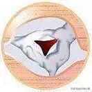 心脏说明书,这份通俗易懂的心脏说明书请收好