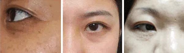 眼霜有必要用好一点的么,眼霜一般有没有用