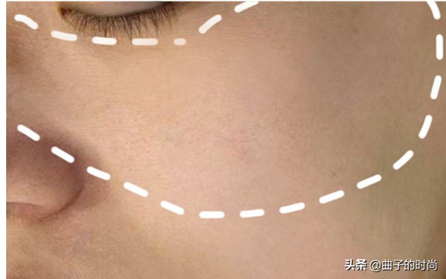 祛斑走过太多的弯路最有效的方法,祛斑最有效方法日晒斑