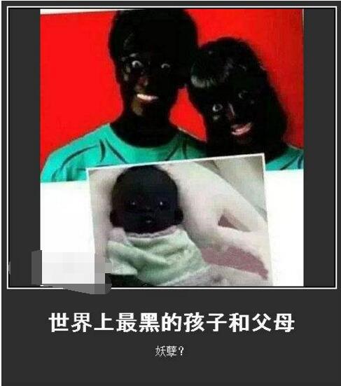 世界上皮肤最白的女孩,世界肤色最黑的人