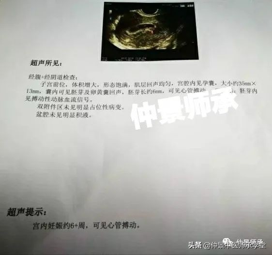 中医治多囊最好的方子,中医治疗多囊用西药吗