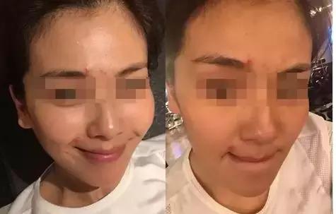 一到晚上皮肤暗沉发黄,一到下午皮肤暗沉