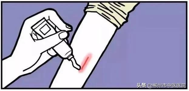 一受伤就会留疤,疤痕体质的疤凸起十几年了怎么治