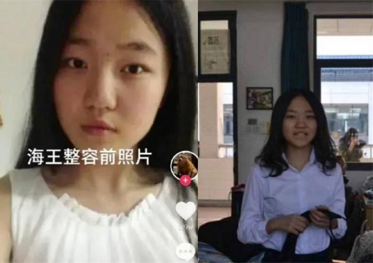 项思醒与整容医生聊天记录曝光，多次预约做手术，钱都让男友报销