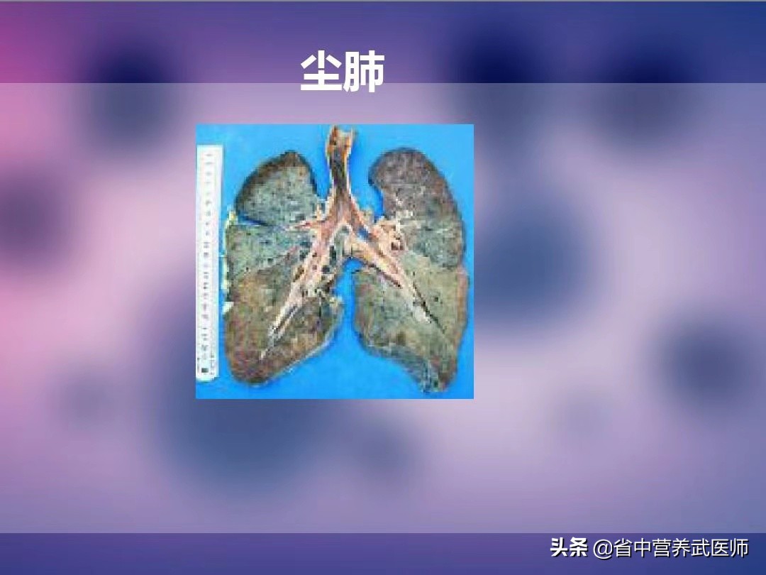 人的肺坏了还能活吗,人的肺损坏了还能活多久