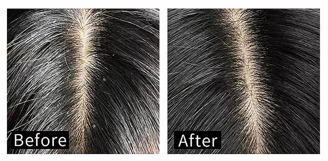 明星推荐的洗发水哪款最好用,明星同款洗发水又顺又香