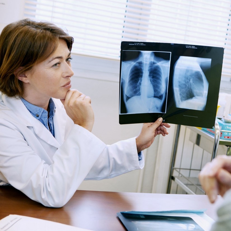 大叶肺炎恢复后期咳嗽厉害,大叶肺炎恢复期一般是多久