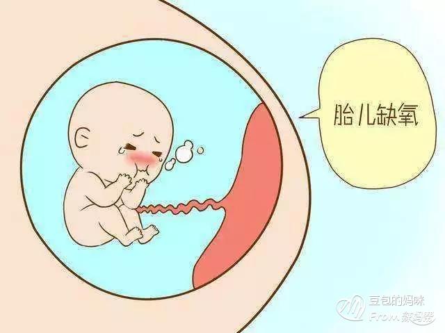 宫内缺氧的预兆,胎儿宫内慢性缺氧出生后如何补救