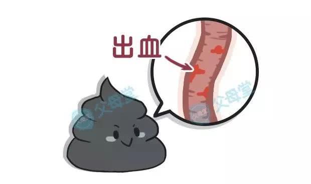 关于宝宝大便次数的问题,关于宝宝便便简单总结