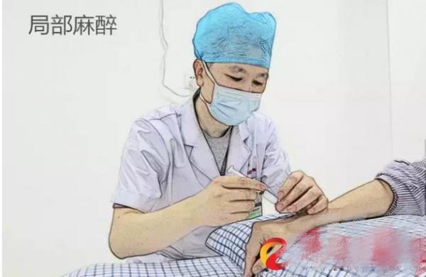 术中知晓为什么是重大医疗事故,怀疑手术有医疗事故怎么处理