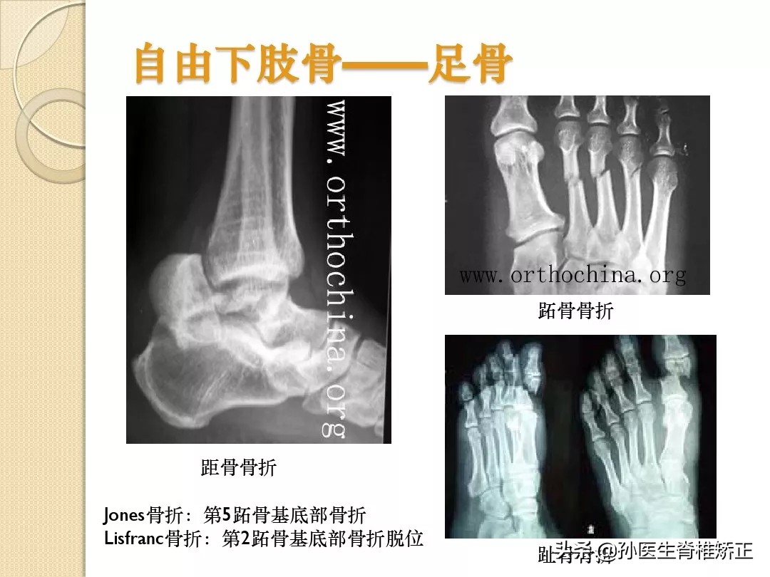 人体解剖学骨骼学思维导图,人体骨骼解剖学纪录片