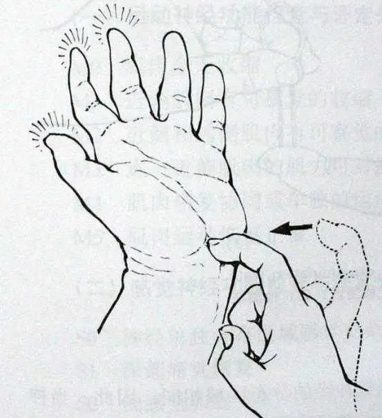 手麻是什么原因造成的怎样治疗,手麻是五种原因引起的要警惕