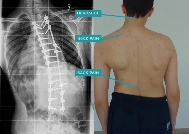 sps鍒涘浜虹悊鏌ュ痉,鐞嗘煡寰蜂翰鎺坰ps瀵煎笀